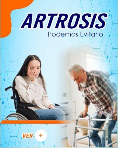 como soluciono el problema de artrosis